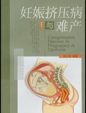 妊娠挤压病与难产