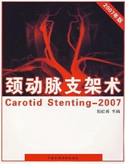 颈动脉支架术  2007年版