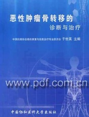 恶性肿瘤骨转移的诊断与治疗