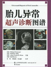 胎儿异常超声诊断图谱