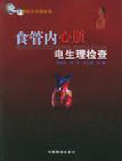 食管内心脏电生理检查