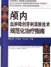 颅内血肿微创穿刺清除技术规范化治疗指南