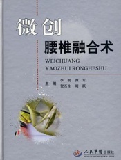 微创腰椎融合术