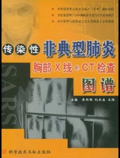 传染性非典型肺炎胸部X线与CT检查图谱