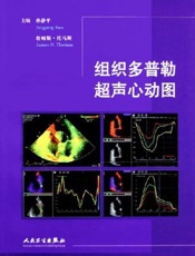 组织多普勒超声心动图