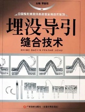 埋没导引缝合技术