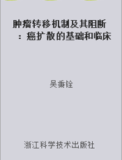 肿瘤转移机制及其阻断：癌扩散的基础和临床