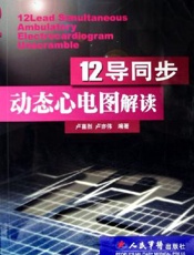 12导同步动态心电图解读
