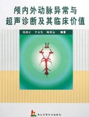 颅内外动脉异常与超声诊断及其临床价值