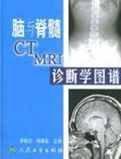 脑与脊髓CT、MRI诊断学图谱(下册)