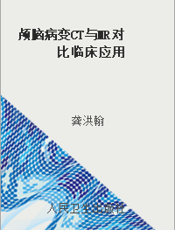 颅脑病变CT与MR对比临床应用