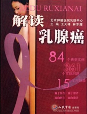 解读乳腺癌